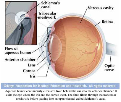 glaucoma informaton